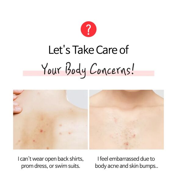 TIA'M, Anti Blemish Body Lotion Back & Chest 200ml - Picture 2 of 12